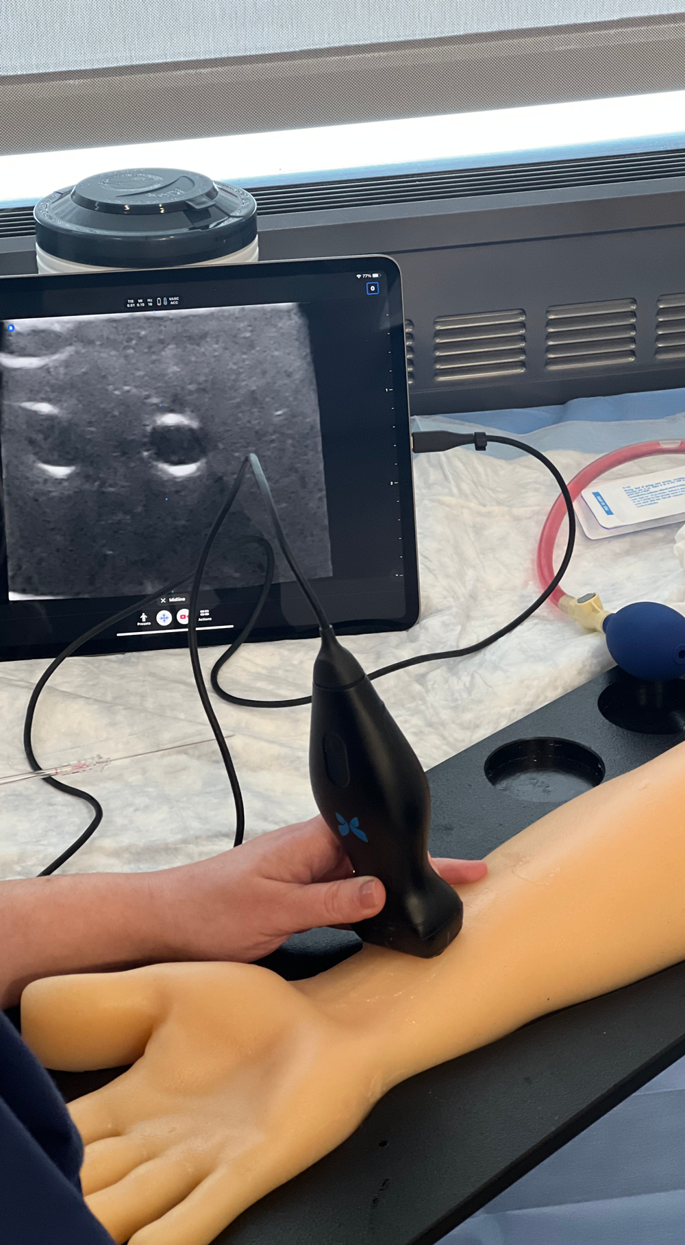 Using a Butterfly IQ to perform an ultrasound on forearm